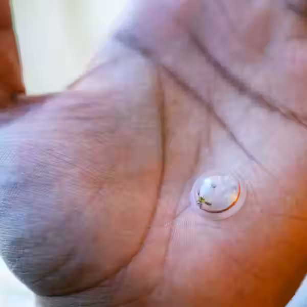 455bc5a2abdc0398c212278d1c727b59