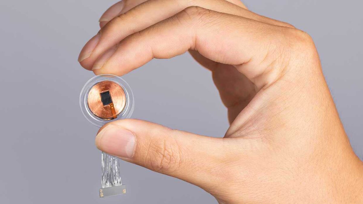 Neuralink впервые имплантировал нейрочип в мозг человека 4 fe0eff8cf0bd351566a60a9534584015