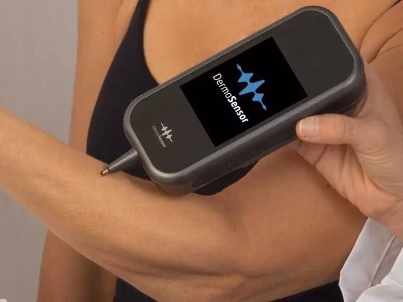 Выпущен карманный ИИ-детектор рака кожи – DermaSensor 1 scale 1200 4 2
