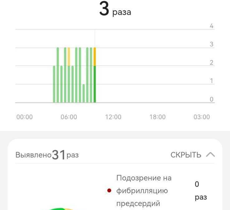 Экран анализа пульсовой волны и аритмии на Huawei Watch GT 4