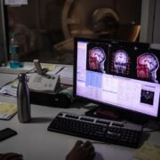 Precision Neuroscience, конкурент Neuralink, привлек $93 млн для разработки мозговых имплантов (9a6145240a553e740bb49c6a4e4809a4)