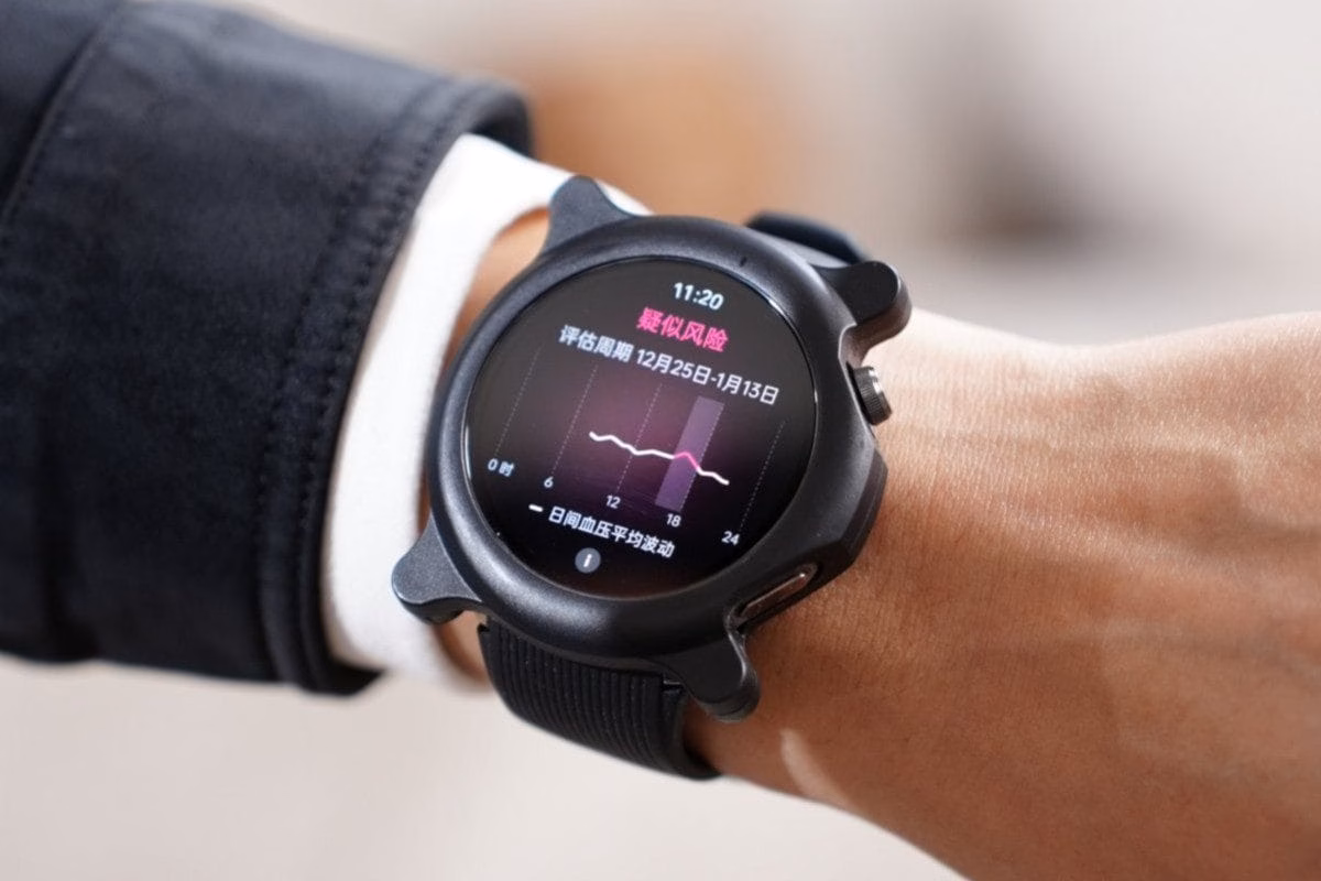 Часы OPPO Watch X2 получат функцию мониторинга АД 2 OPPO Watch X2