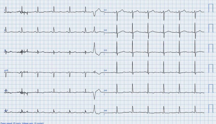 Samsung рассказал о новой функции Galaxy Watch и других носимых устройств 5 qirtli45d3z2cjurt6eywpktu0cfk692tc2vr